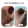 Silikónový gél na odstránenie jaziev Scarex Biotrade 15ml