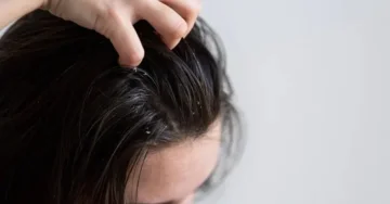 What causes oily hair and how to deal with it?