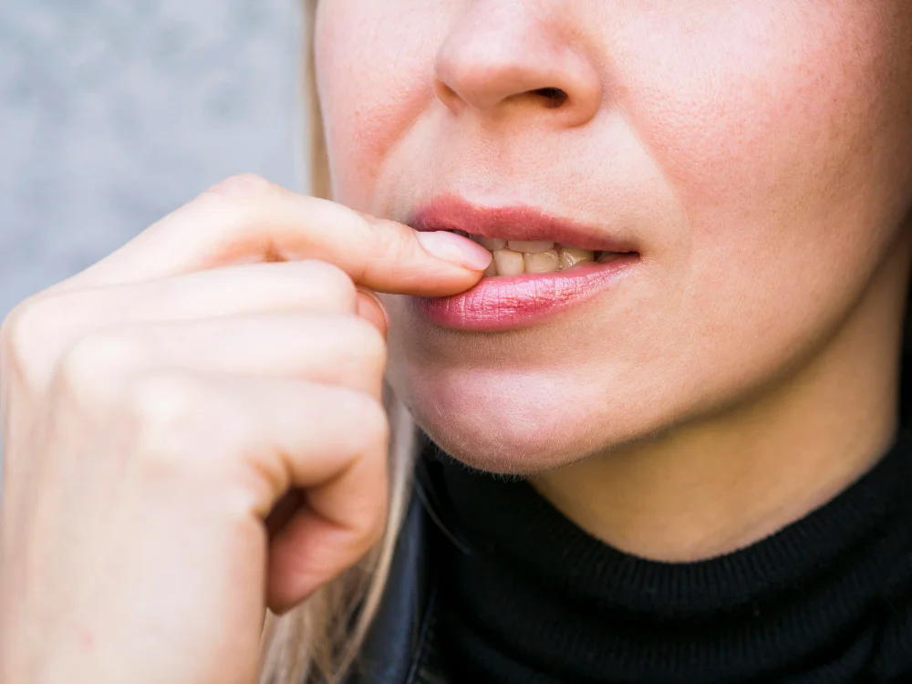 Canker sores and toothpaste - why fluoride-free toothpaste is often recommended