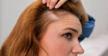 Warum fallen mir die Haare aus? Die häufigsten Ursachen und ihre Lösungen