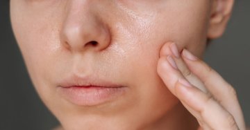 Warum ist Ihre Haut immer noch fettig? 5 Fehler, mit denen Sie die Talgproduktion paradoxerweise erhöhen